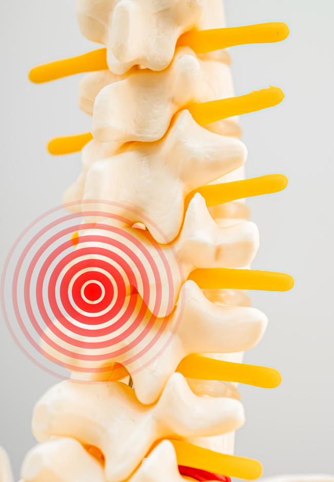 explications des raisons du lumbago quand on est actif